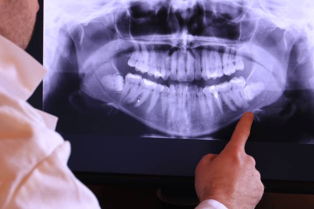 Best Pediatric Emergency Dentist in Rockport, IN