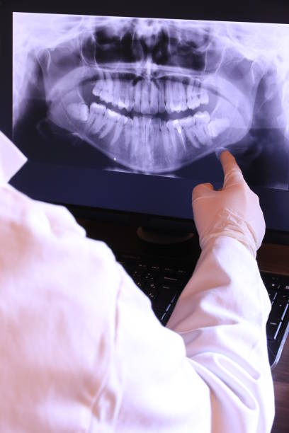 Best Emergency Tooth Extraction in Rockport, IN