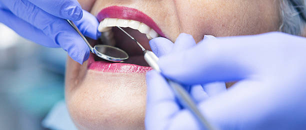 Best Emergency Treatment for Toothache in Rockport, IN